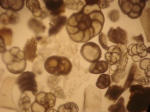 foraminiferas
